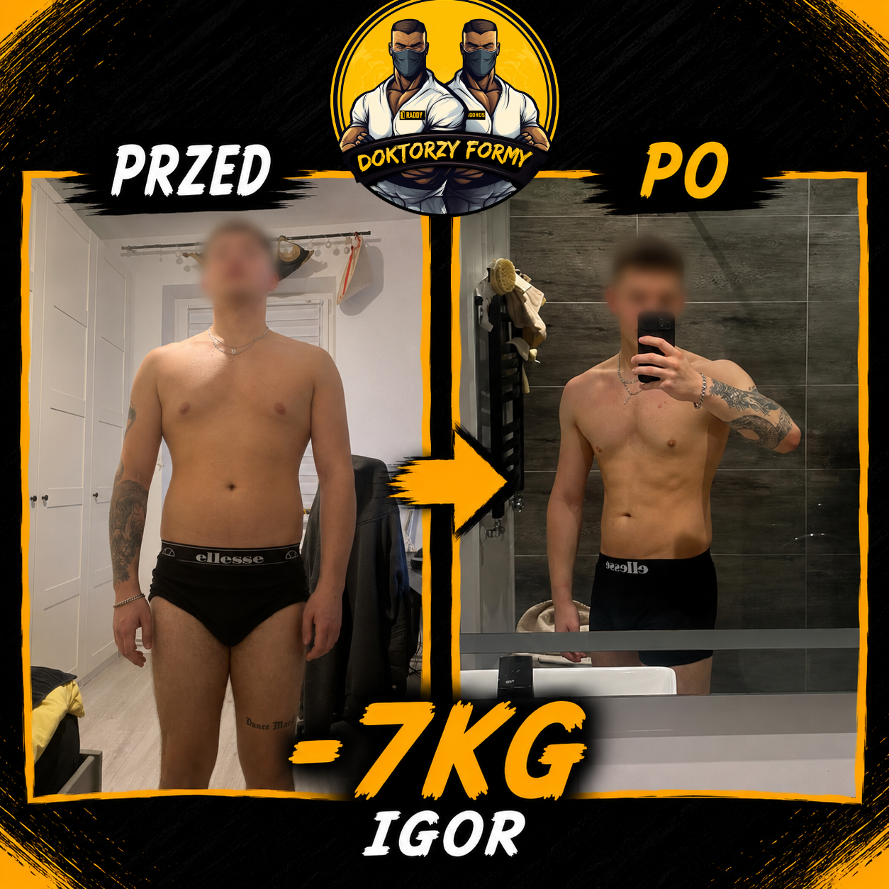Metamorfoza klienta Igora - Doktorzy Formy
