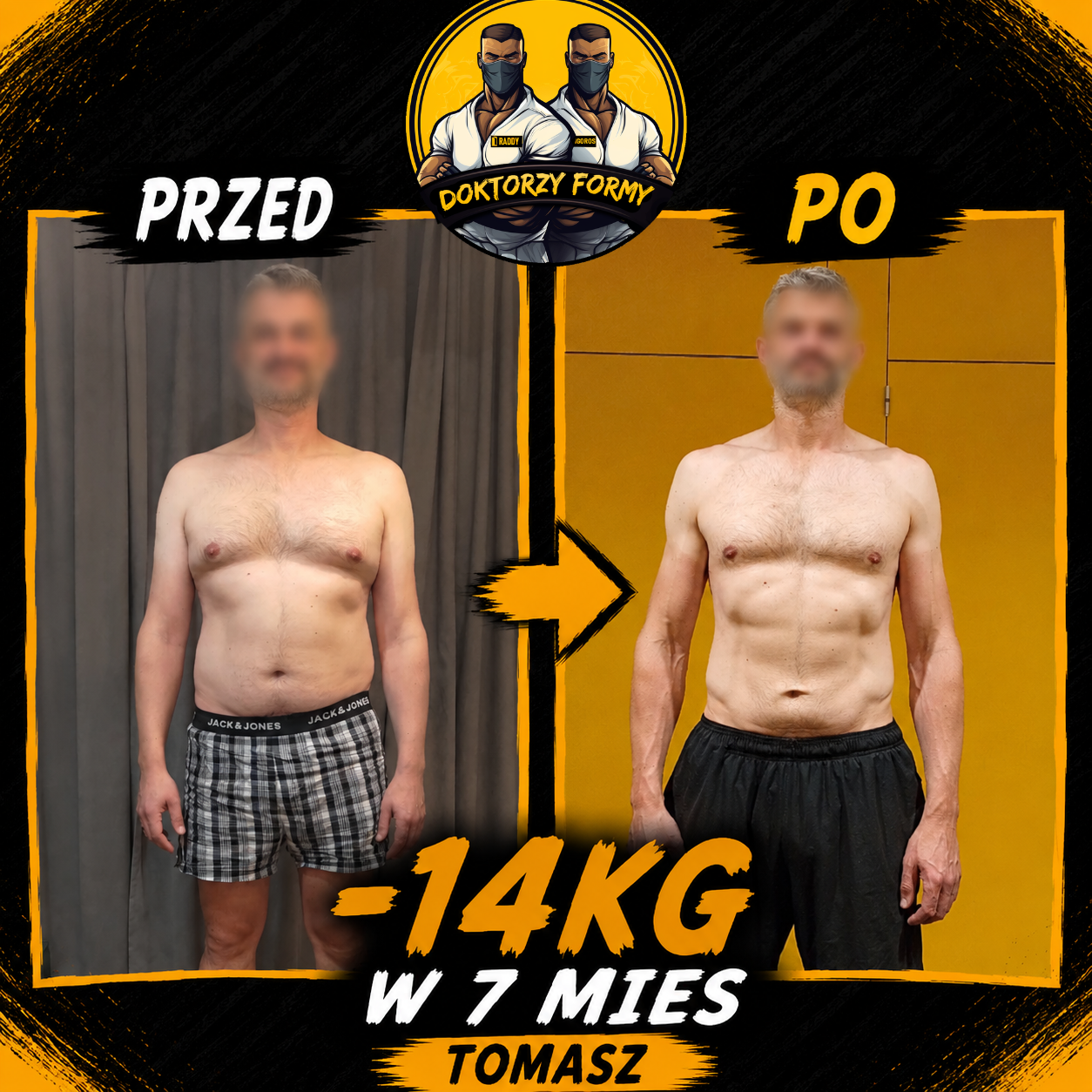 Metamorfoza klienta Tomasza - utrata 14 kg - Doktorzy Formy
