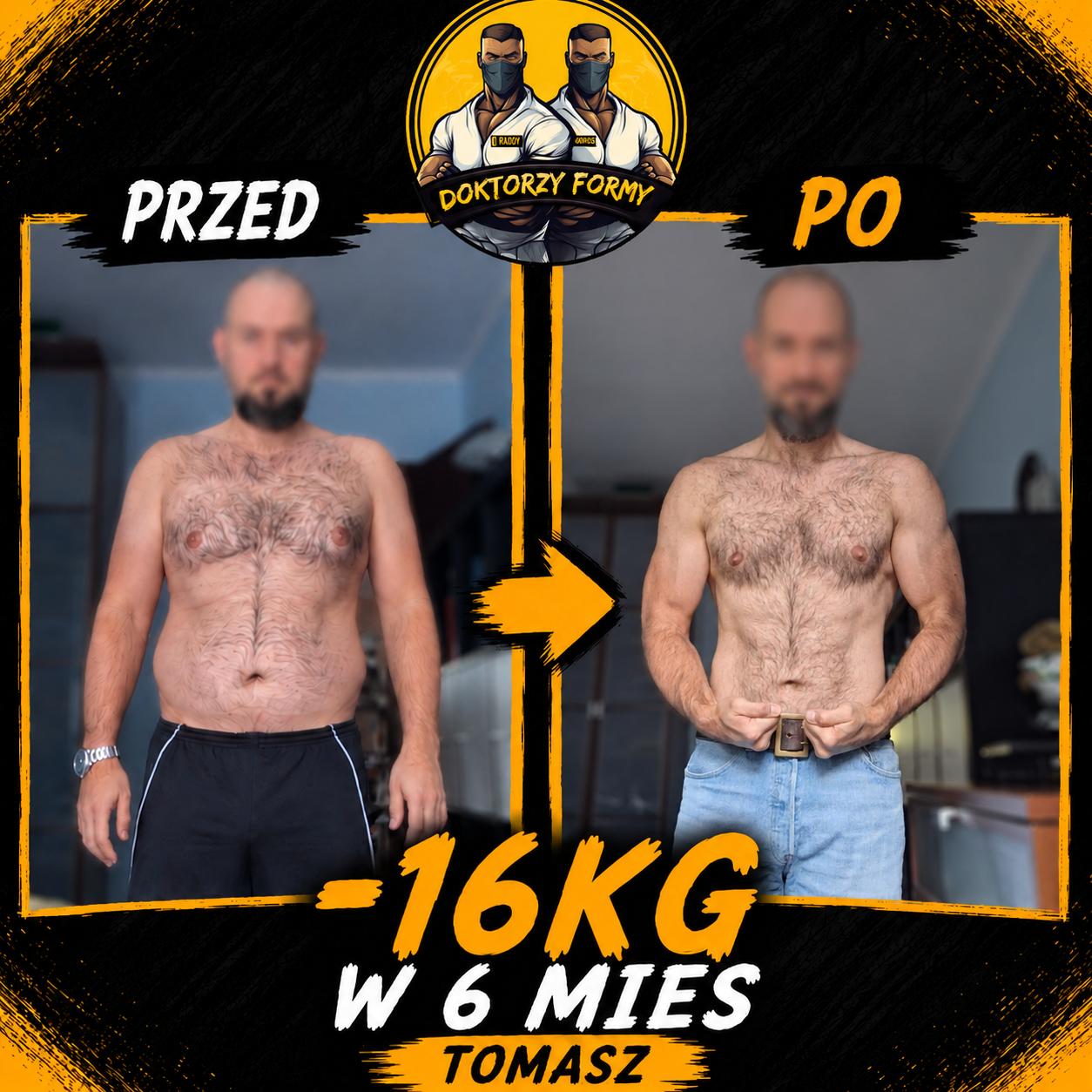 Metamorfoza klienta Tomasza - utrata 16 kg - Doktorzy Formy